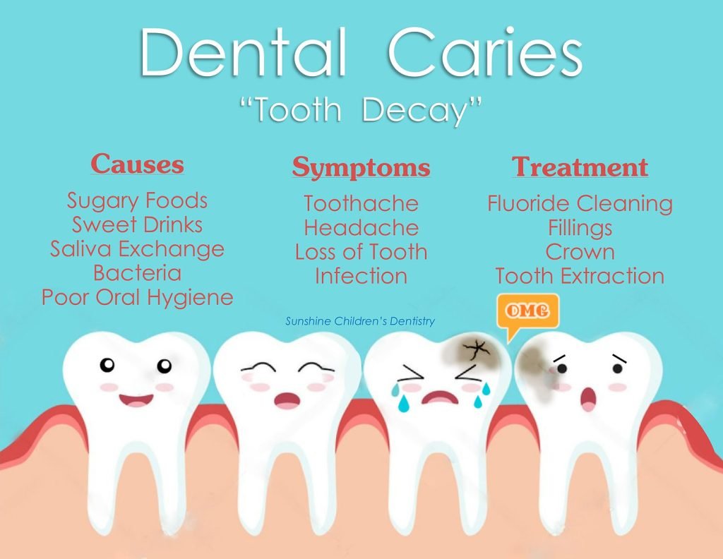 9 Super Useful Tips To Improve top dental implants in Dwarka