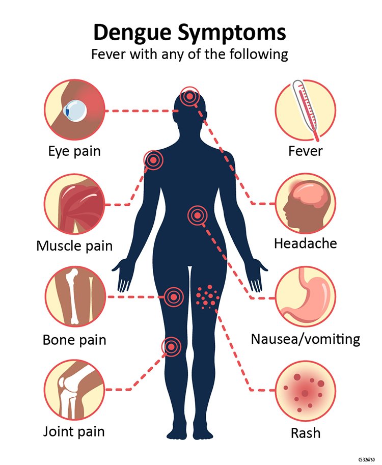 Dengue fever
