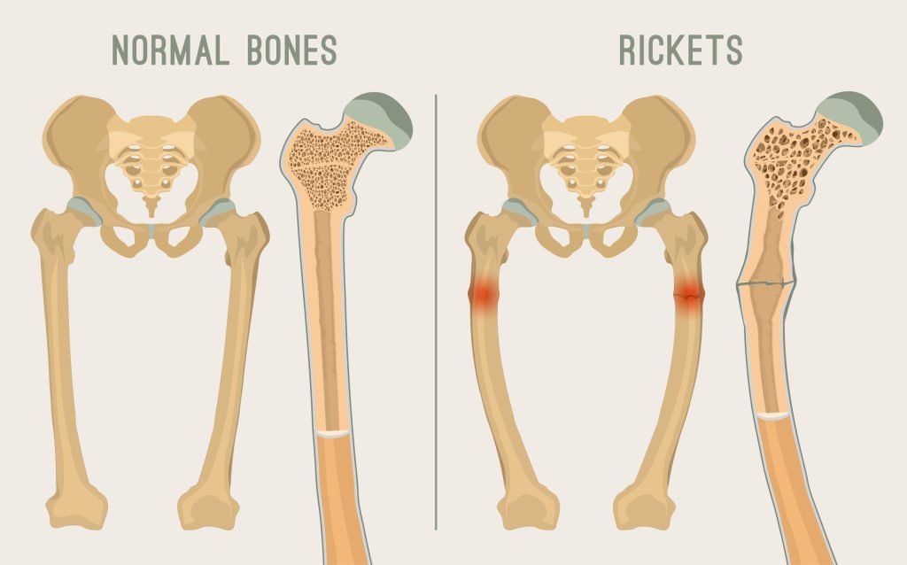 Reckets
