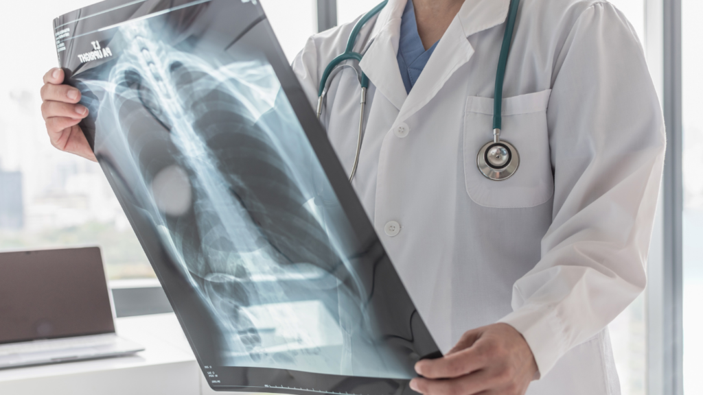 Occupational Lung Disease