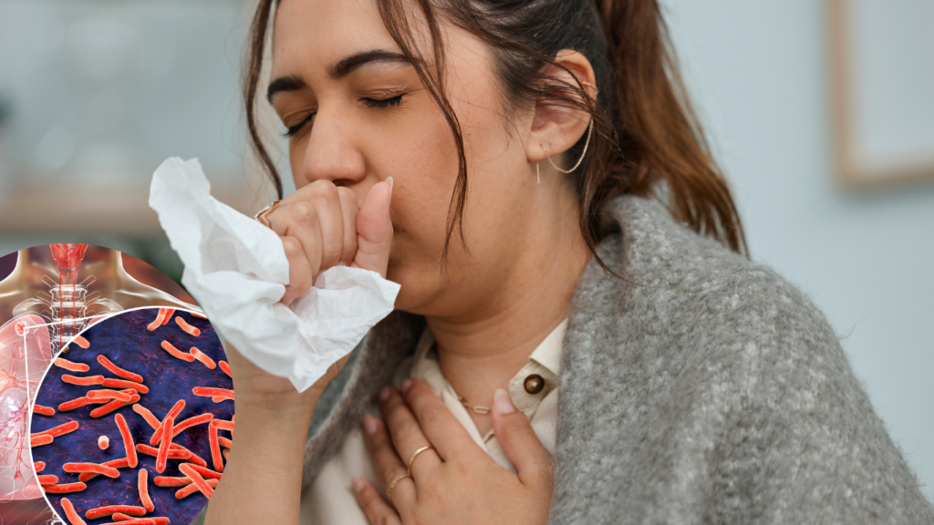 Tuberculosis