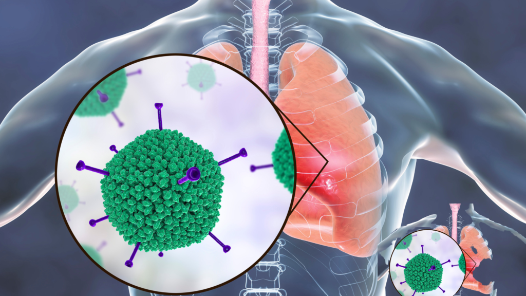 Upper Respiratory Tract Infections