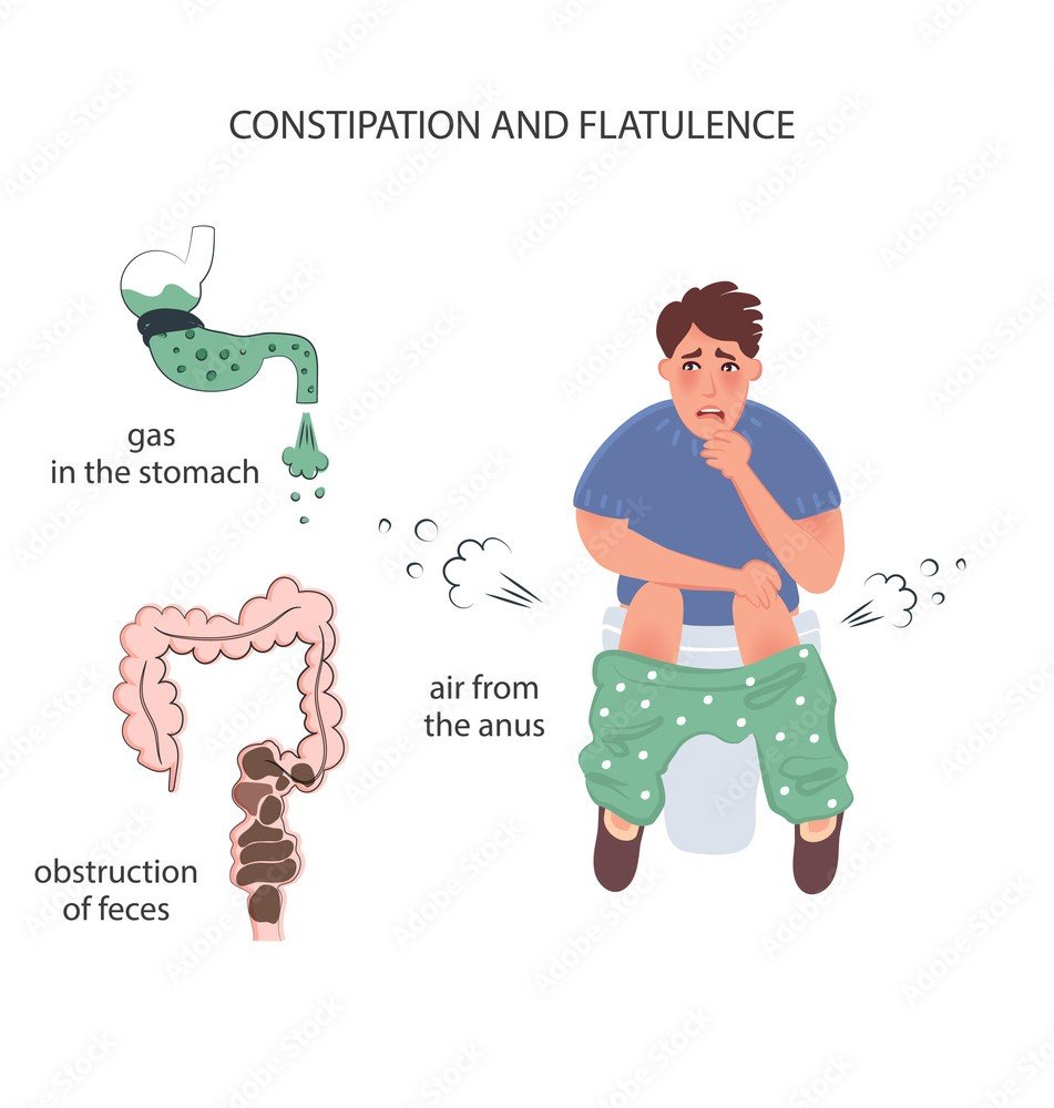 Constipation And Flatulence