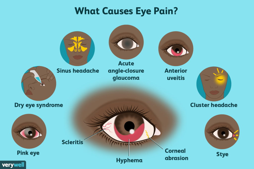 Glaucoma