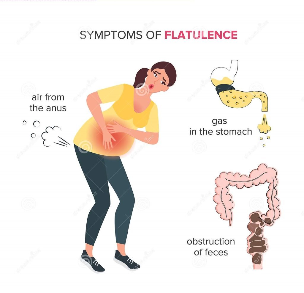 flatulence-constipation-young-girl-air-outlet-anus-gas-stomach-fecal-obstruction-intestines