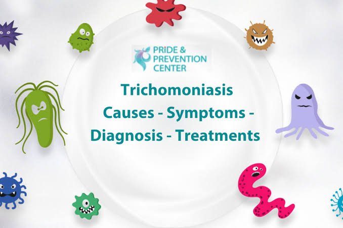 trichomoniasis