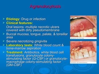 Agranulocytosis