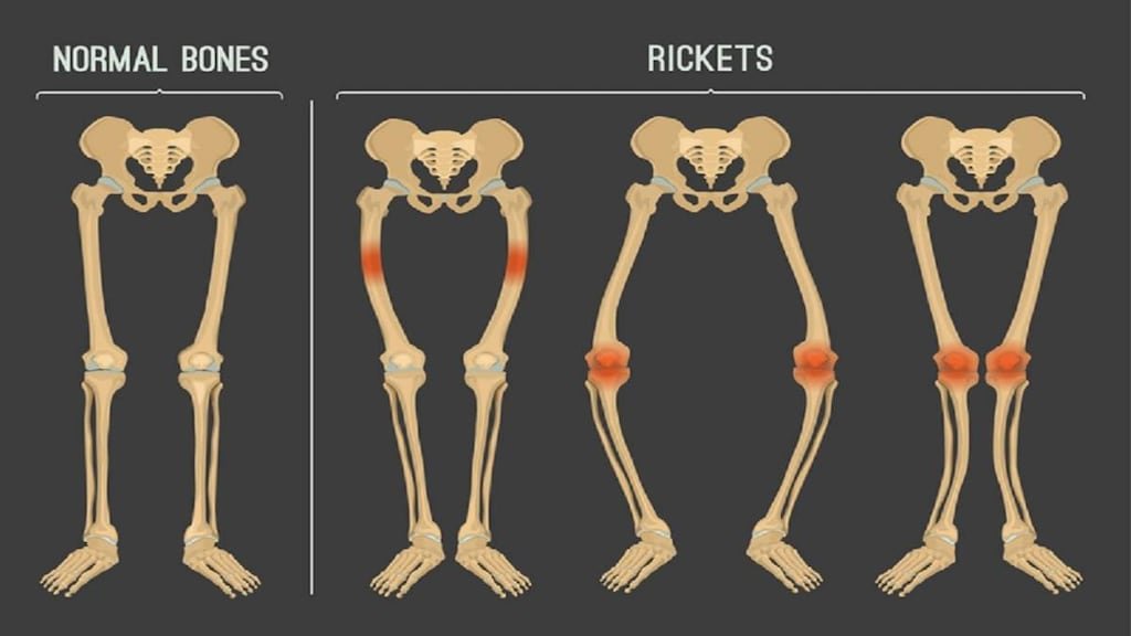 Reckets