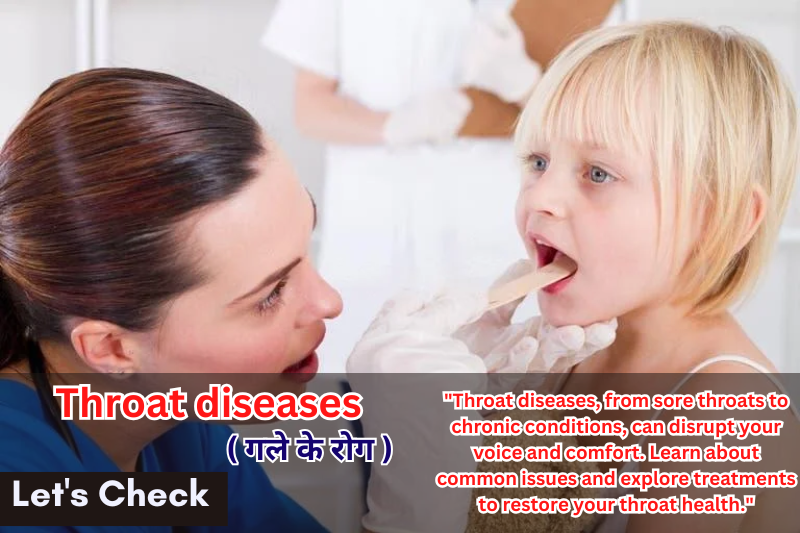 Throat diseases