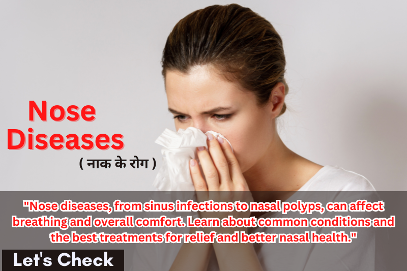 Nose Diseases