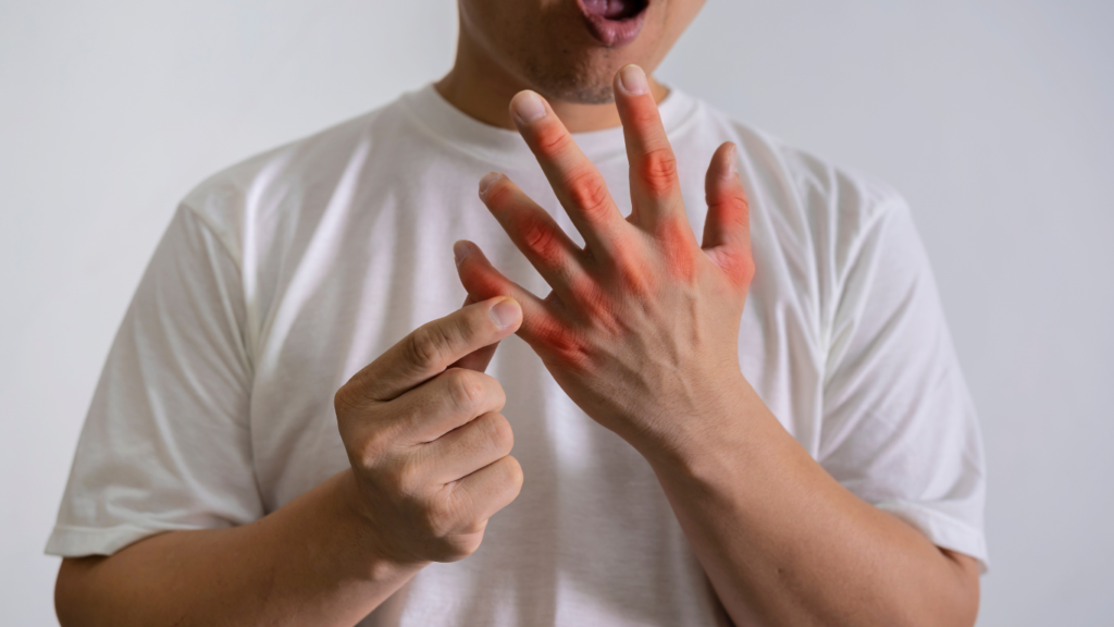 Gout