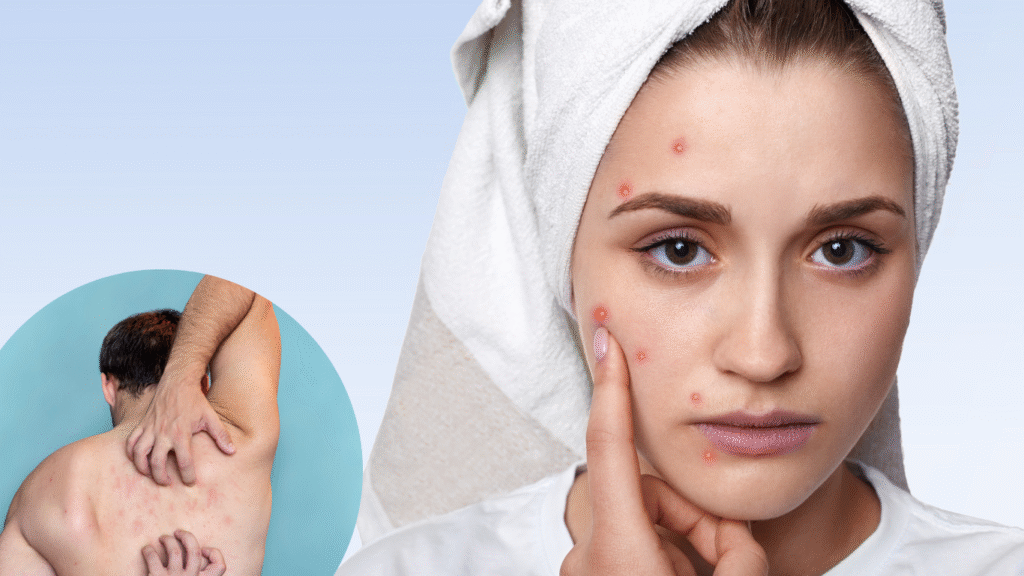 Skin Allergy